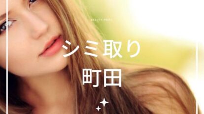 シミ取り　町田　アイキャッチ